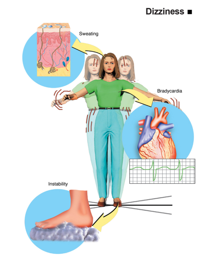 Infografis dizziness